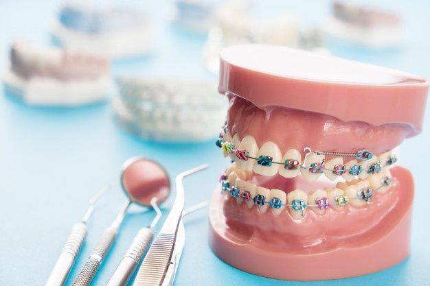 La idea de llevar brackets suele asociarse más con adolescentes. Sin embargo, cada vez más adultos optan por corregir la alineación de sus dientes utilizando esta herramienta. Los avances en tecnología dental han transformado la forma en que vemos los brackets, haciéndolos más discretos y cómodos para personas de todas las edades. Si estás considerando la posibilidad de mejorar la alineación de tus dientes como adulto, aquí te presentamos una guía definitiva que te ayudará a comprender mejor el proceso y a mantener tu estilo mientras llevas brackets.